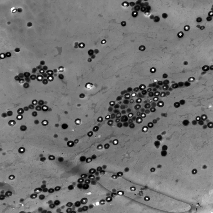 A 1,200-times magnification of a platypus's hollow, spherical melanosomes.
