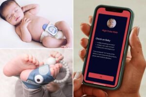 Does your baby need a high-tech wearable health tracker?