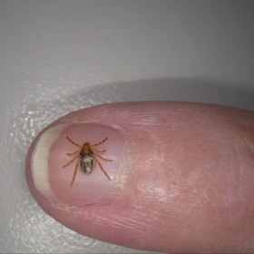 Mammalian Meat Allergy is caused by ticks and triggers an allergy to red meat, pork or any other product derived from a mammal.