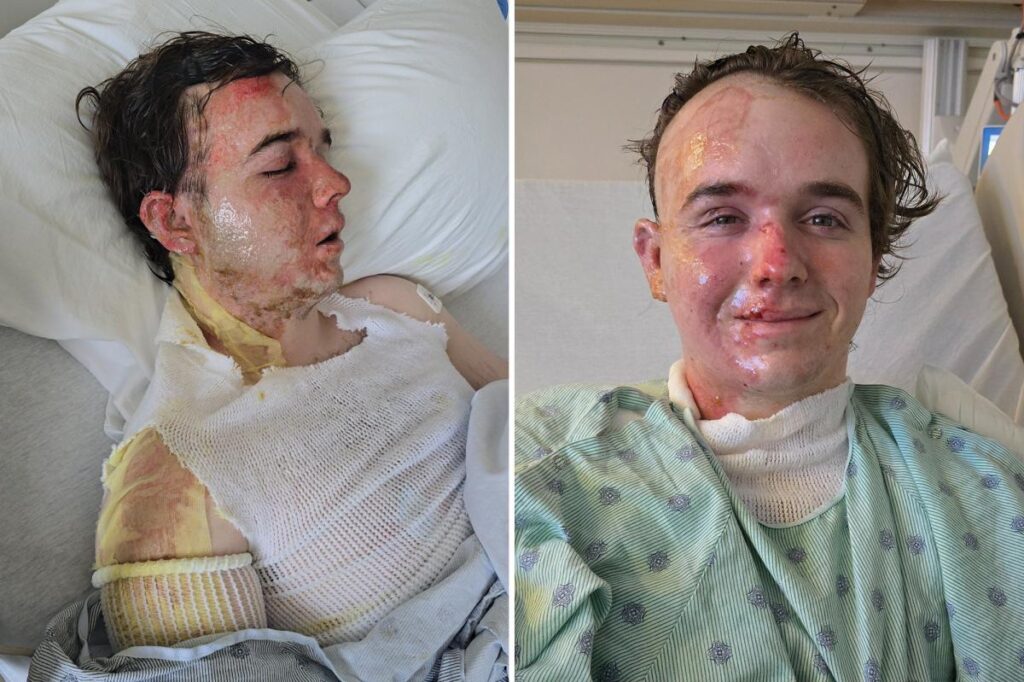 McDonald’s employee in ICU after coworker allegedly threw hot oil on him: ‘Why would he do this to me?’