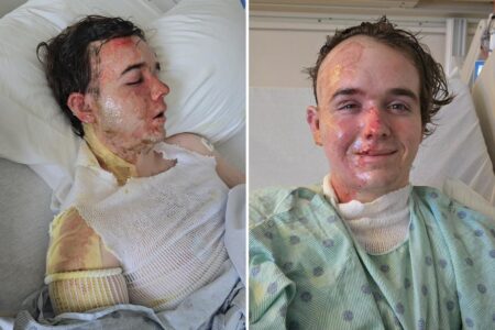 McDonald’s employee in ICU after coworker allegedly threw hot oil on him: ‘Why would he do this to me?’