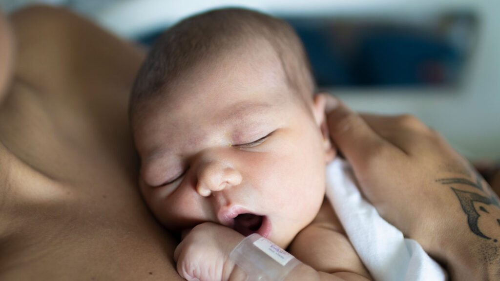 Why more male than female newborns may get the crucial vitamin K shot