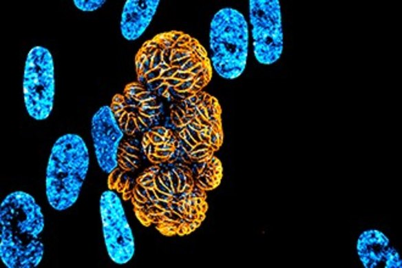 A Toxoplasma-infected human cell before it bursts.