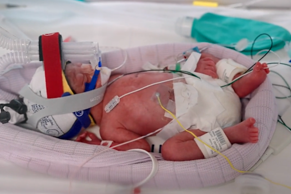 The four girls – Emily, Harriet, Alexa and Catherine – were delivered via caesarean section.