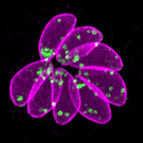 Toxoplasma gondii under the microscope.