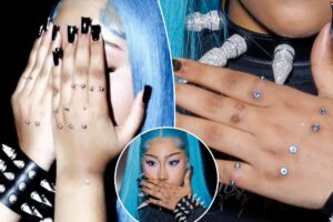 North West’s hand piercings put her at risk for scarring and disfigurement, doctor warns