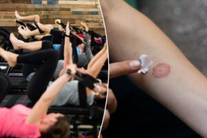 Premium $46-per-class fitness studio is leaving gymgoers with ringworm: reports