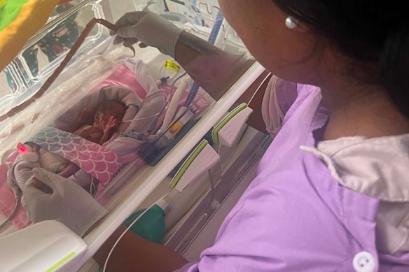 Miracle made the RBWH’s intensive care unit her home for 14 weeks.