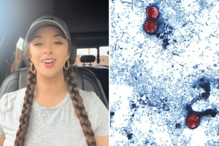 TikTok food critic, 29, details ‘miserable’ experience of contracting ‘explosive diarrhea’ parasite