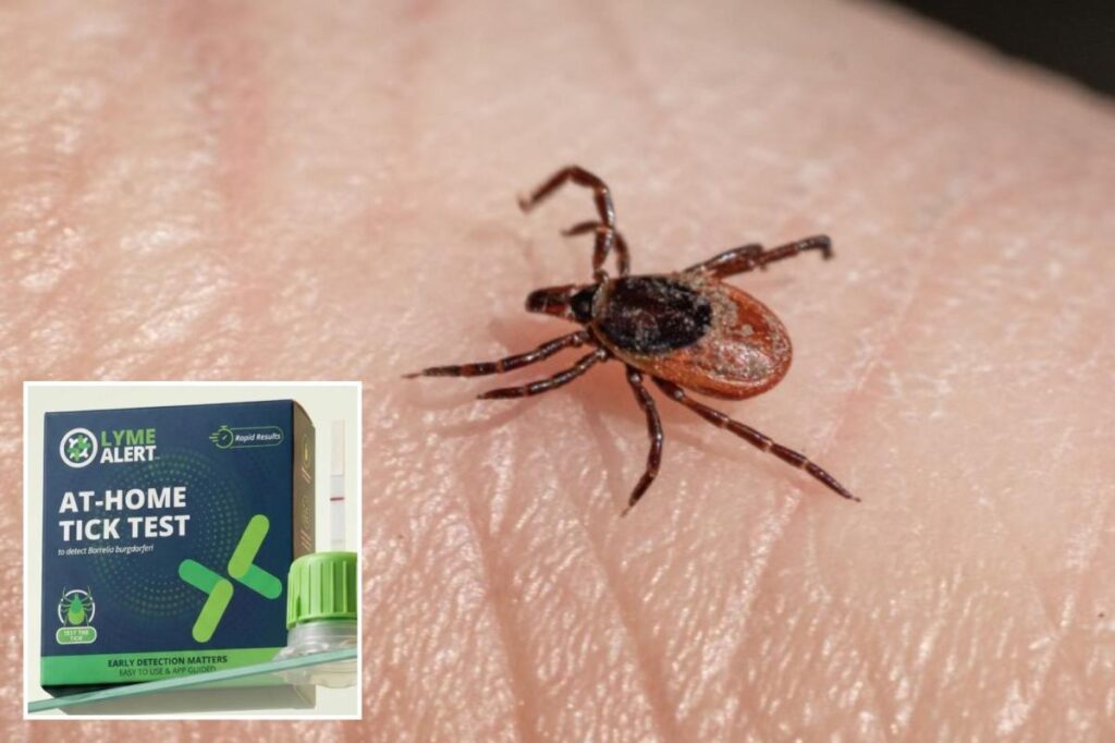 ‘TickCrusher’ kit that could help you dodge weeks of Lyme disease anxiety in 15 minutes