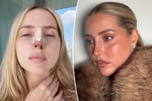 Why this beauty influencer tried to hide her $17,000 Beverly Hills nose job