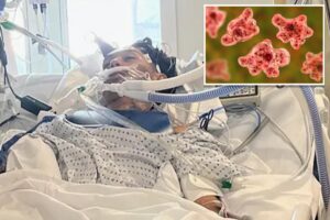 North Carolina teen dies from rare brain-eating amoeba typically linked to freshwater swimming