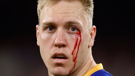Oscar Allen leaves the field under the blood rule during Brisbane’s preliminary final win over Hawthorn.