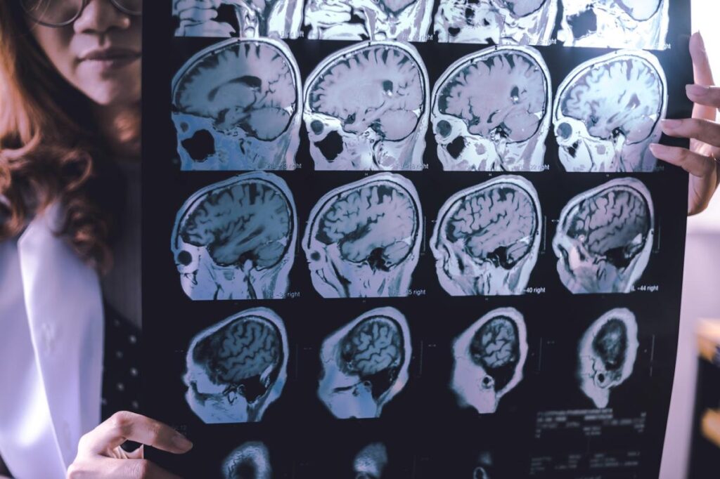 This family’s heartbreaking struggle with dementia in midlife may upend our understanding of the disease — and hope for a cure