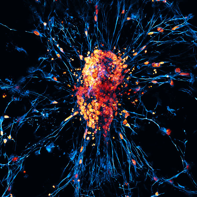 Bright clusters of cell nuclei dot a branching web of human neurons grown from reprogrammed stem cells.