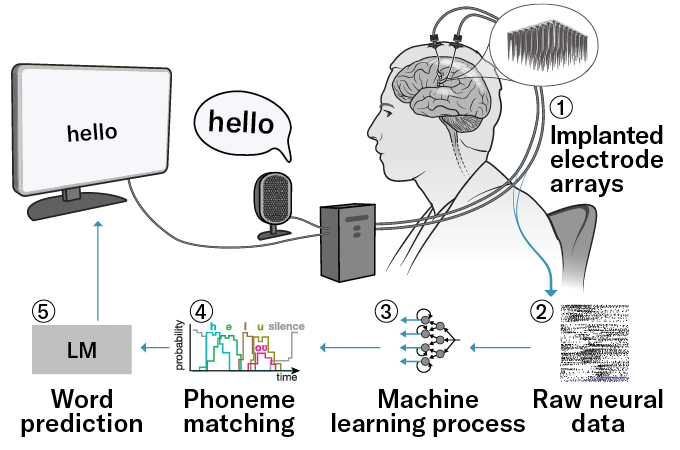 A graphic explaining how Casey Harrell’s brain-computer functions (described by caption)