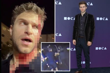 ‘Pretty Little Liars’ star pistol-whipped in terrifying West Hollywood robbery calls out Karen Bass, Gavin Newsom after attack