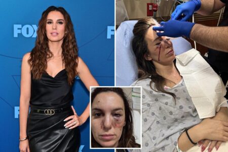 Former Disney star Christy Carlson Romano thought she was ‘going to die’ after freak shooting accident