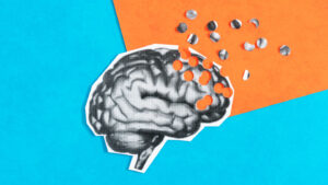 Scarred blood vessels may be one clue to APOE4’s Alzheimer’s risk