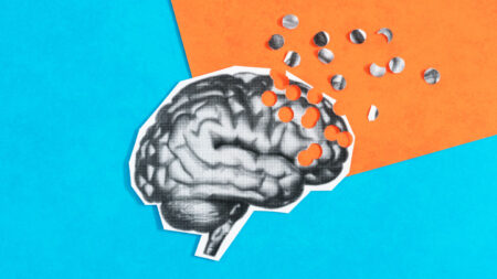 Scarred blood vessels may be one clue to APOE4’s Alzheimer’s risk