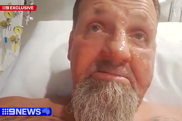Randovan Banic is now being treated for burns following the attack.